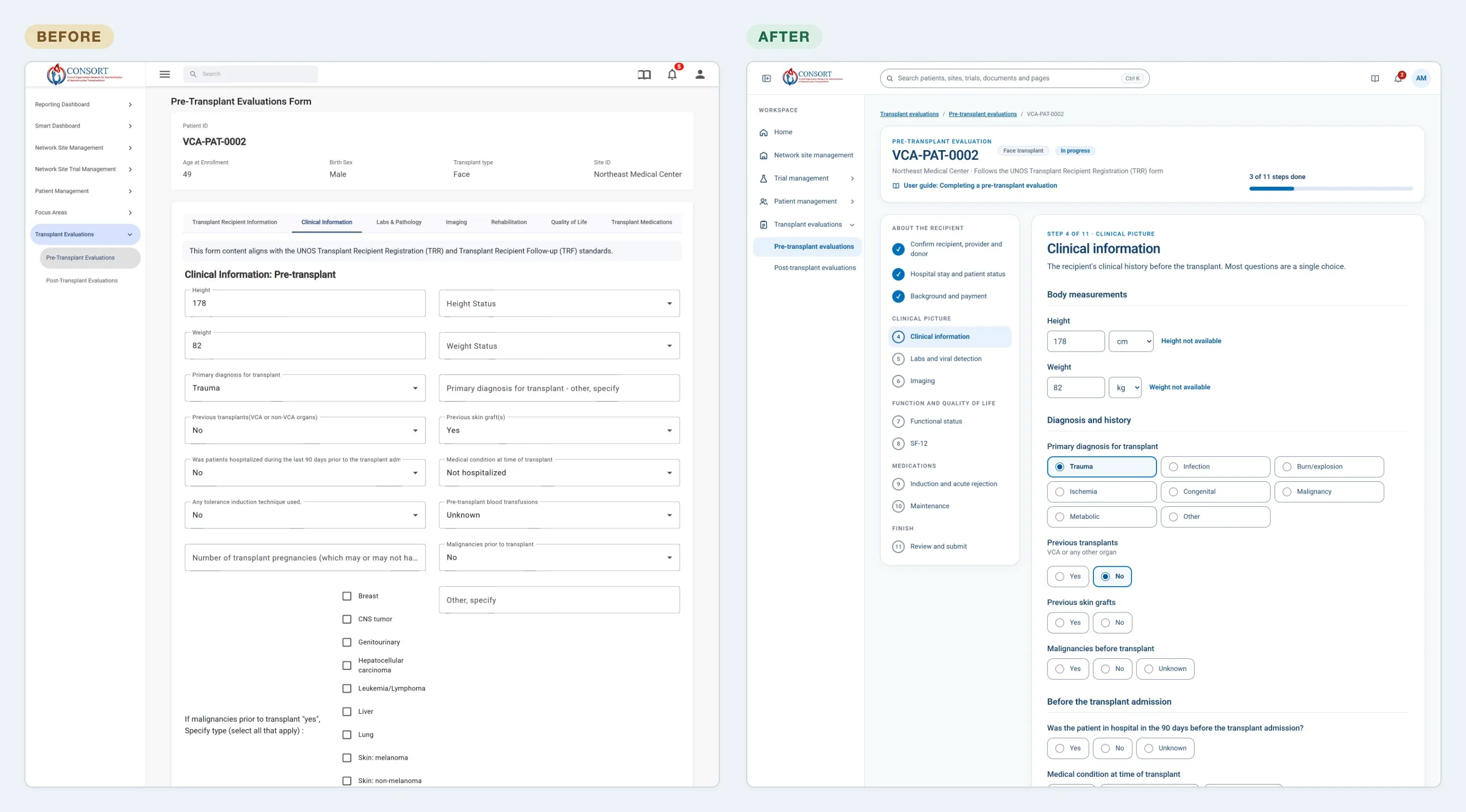 The pre-transplant evaluation before and after: seven tabs of dropdowns in the live app, beside one step of the 11-step guided interview in the prototype.