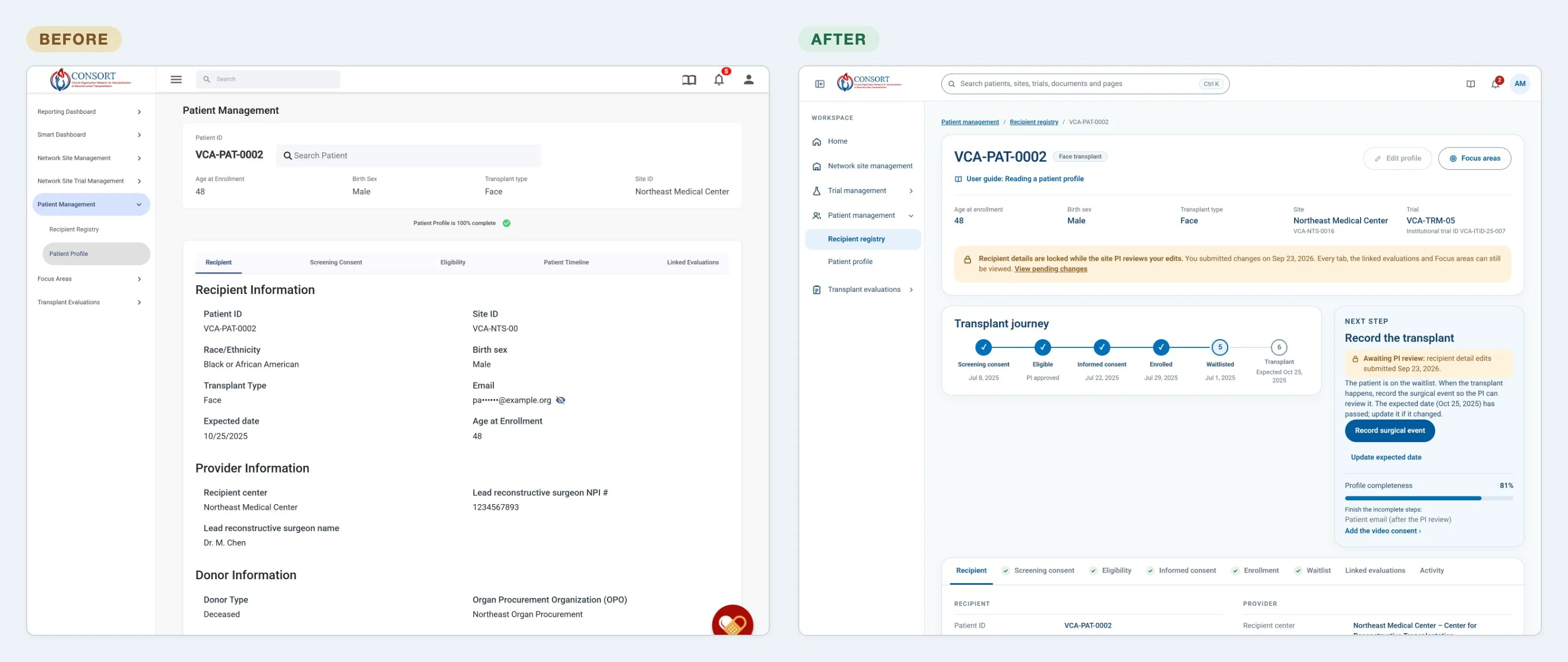 The patient profile before and after: a search box and a list of recorded fields in the live app, beside the prototype's profile with a transplant journey and a Next step panel.