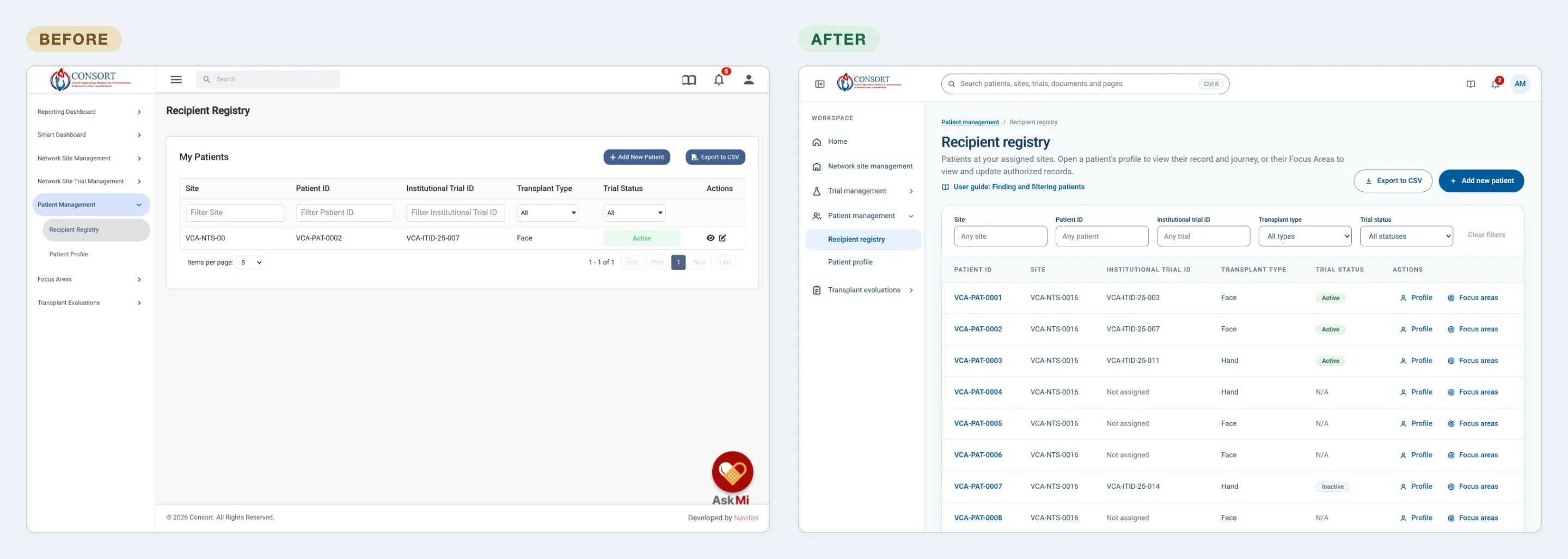 The Recipient registry before and after: icon-only row actions and placeholder-only filters in the live app, beside labeled filters and labeled Profile and Focus areas actions in the prototype.